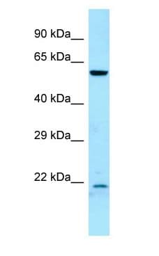 Polyclonal Rabbit anti-Human DYRK2 Antibody (aa401-450, WB)
