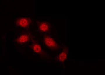 Polyclonal Rabbit anti-Human GATA4 Antibody (phospho-Ser262, IHC, IF, WB)