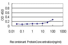 PathPlus™ ENO1 / Alpha Enolase Antibody (clone 8G8)