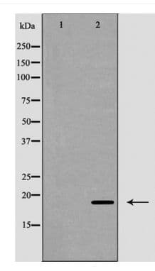 CD247 / CD3 Zeta Antibody (phospho-Tyr142)