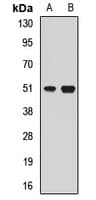 HLX1 / HLX Antibody