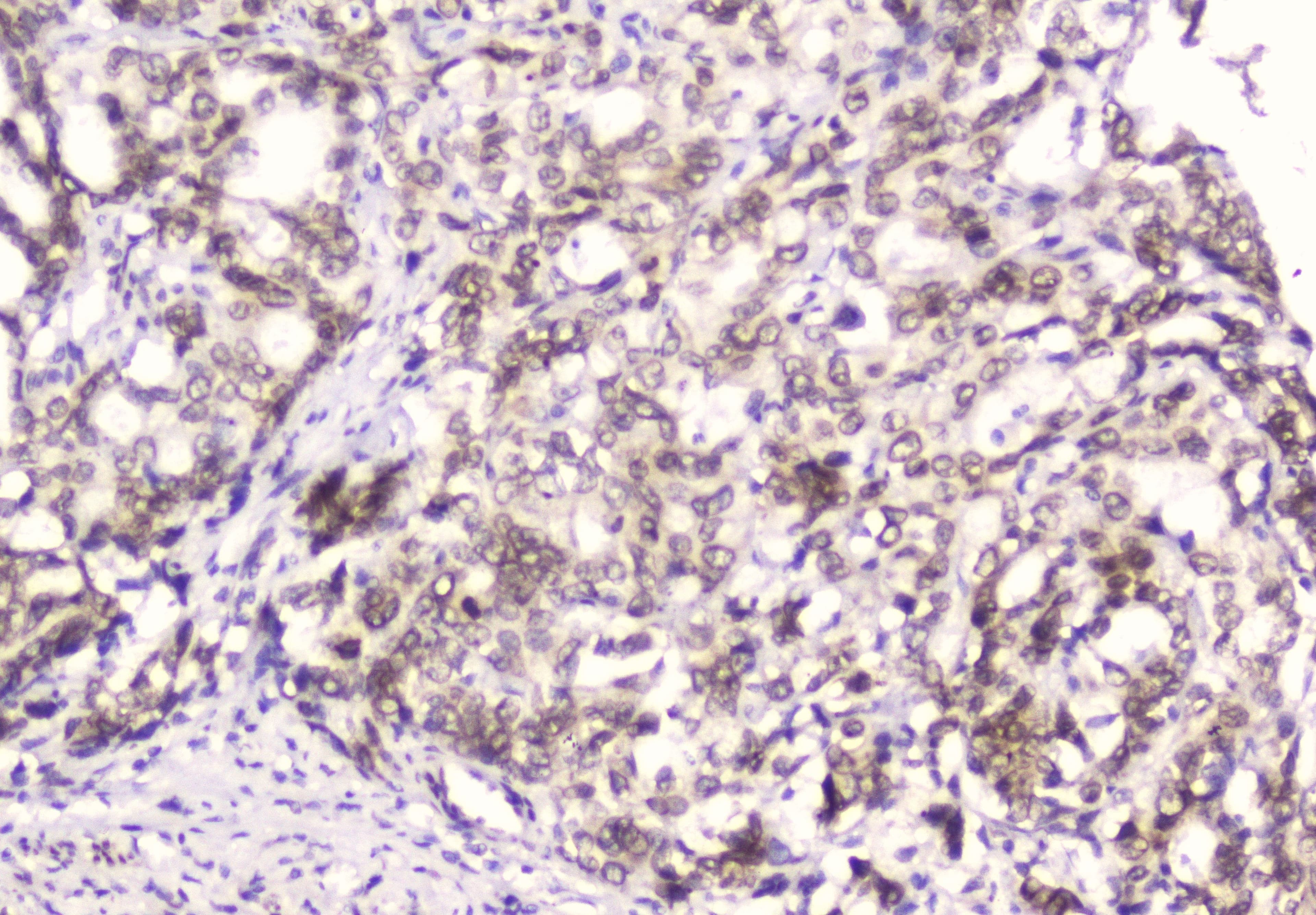 Monoclonal Mouse anti-Human EMD / Emerin Antibody (IHC, WB)