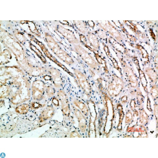 Polyclonal Rabbit anti-Human ART4 Antibody (IHC)