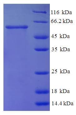 Human NAGK Protein (Recombinant His-SUMO)