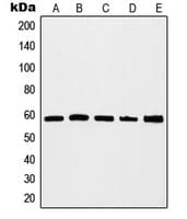 Polyclonal Rabbit anti-Human MYC / c-Myc Antibody (C-Terminus, IHC, IF, WB)