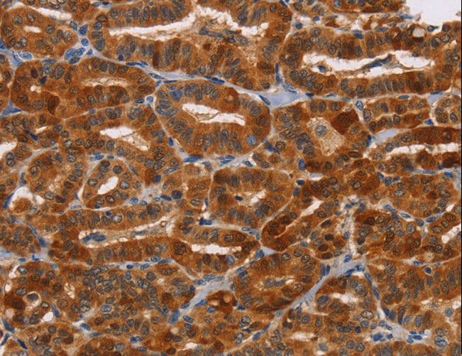 NCR1 / NKP46 Antibody