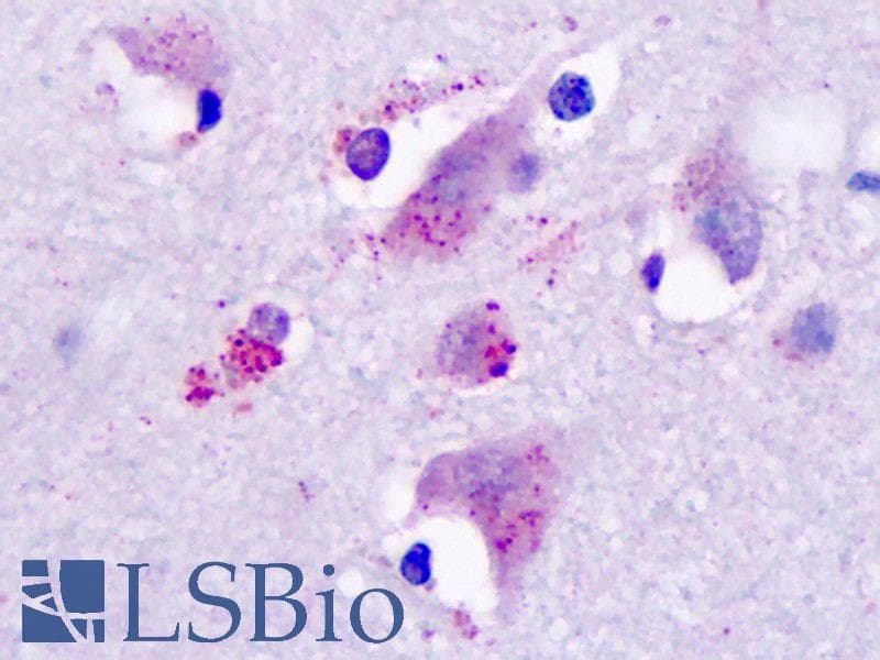 IHC-plus™ Polyclonal Rabbit anti-Human HRH3 / Histamine 3 Receptor Antibody (Cytoplasmic Domain, IHC)