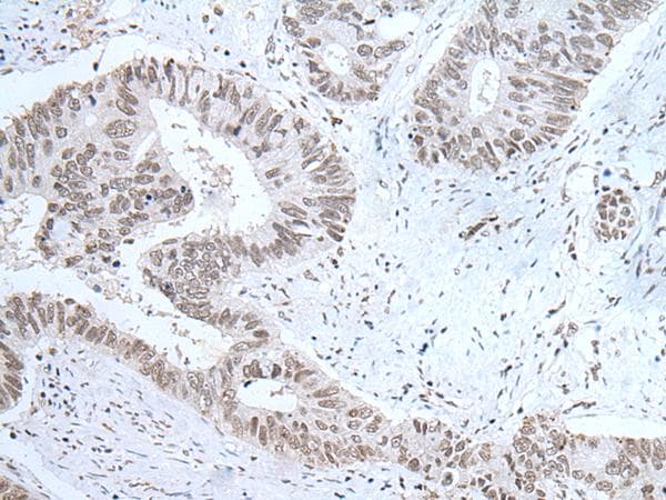 HCRT / Orexin Antibody