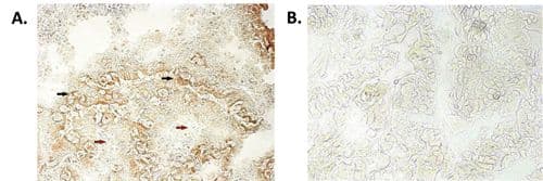 Monoclonal Mouse anti-Human NALP6 / NLRP6 Antibody (clone Clint-1, IHC, WB)