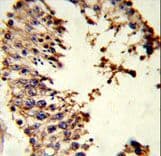 Acrosin Antibody (aa99-127)