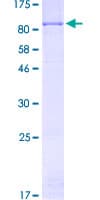 Human ACOX3 Protein (Recombinant GST)