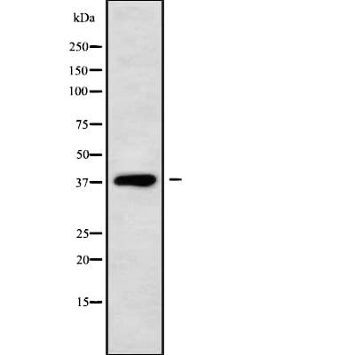 DHRS7 Antibody