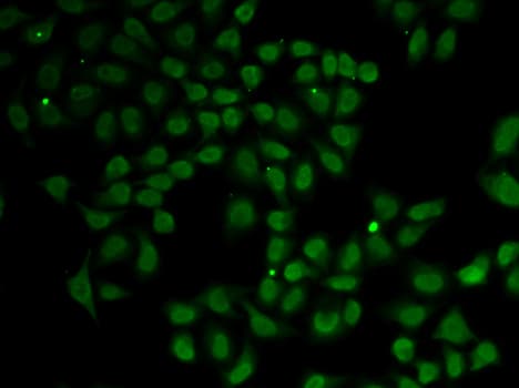 IHC-plus™ LIG3 / DNA Ligase III Antibody