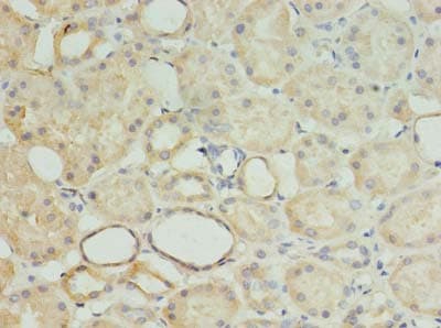 Polyclonal Rabbit anti-Human MRPL18 Antibody (IHC, WB)