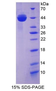 Mouse Aspartate Aminotransferase Protein (Recombinant His)