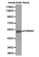 Polyclonal Rabbit anti-Human CHRNA5 Antibody (IHC, WB)