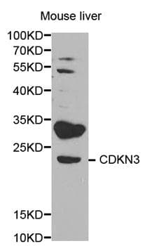 CDKN3 / KAP Antibody