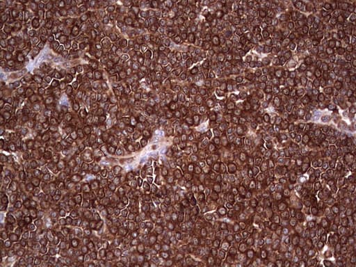 PKM2 Antibody (clone OTI12D5, Carrier-free)