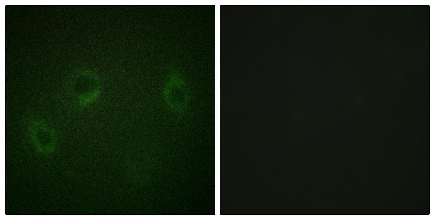 Polyclonal Rabbit anti-Human MARK1+2+3+4 Antibody (p215, IHC, IF, WB)