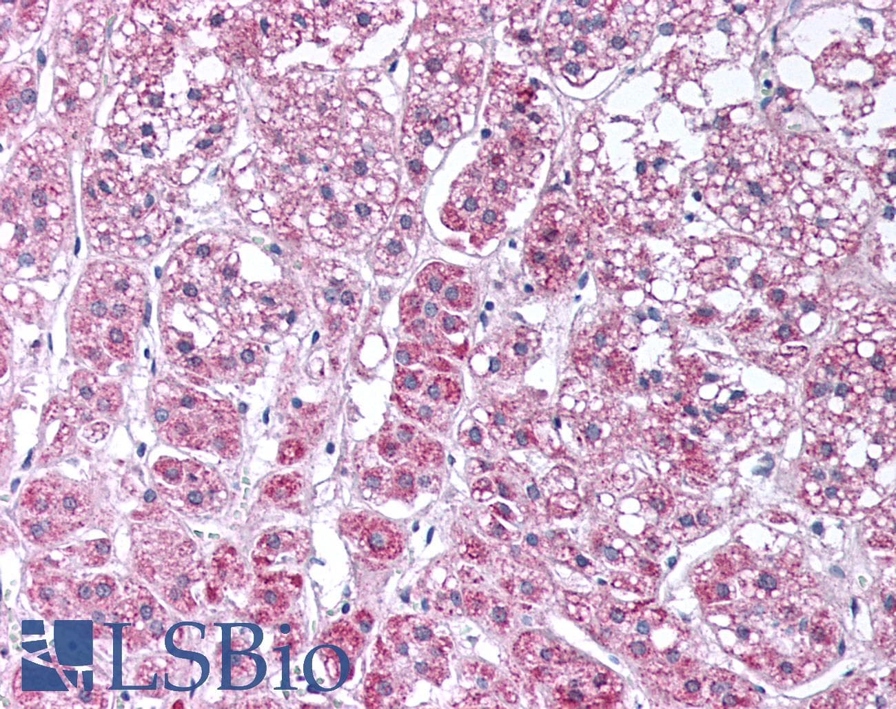 IHC-plus™ COL15A1 / Collagen XV Alpha 1 Antibody (C-Terminus)