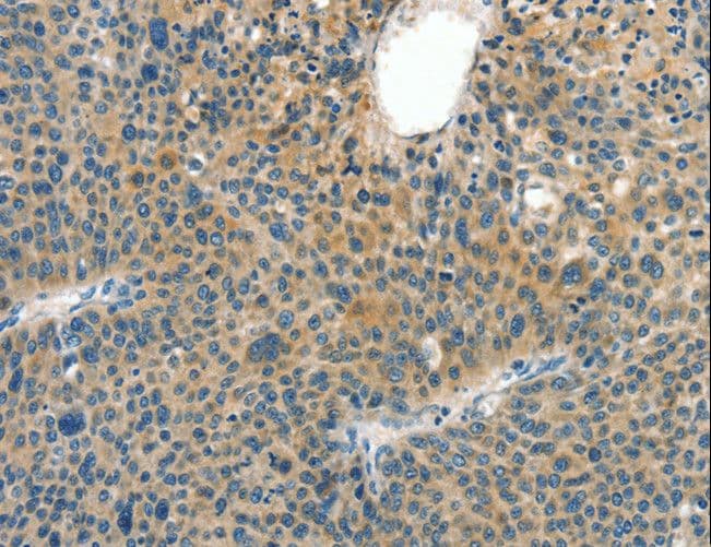 CRLF2 / TSLPR Antibody