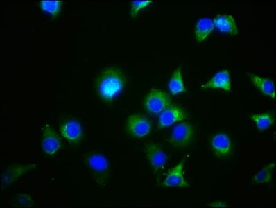 GDF5 / GDF-5 Antibody (aa202-501)