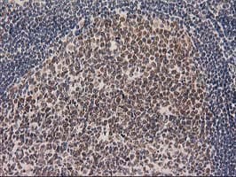 LOX / Lysyl Oxidase Antibody (clone OTI10D11)
