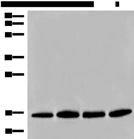 Polyclonal Rabbit anti-Human HIST1H2BA Antibody (IHC, WB)