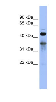Polyclonal Rabbit anti-Human RBFOX2 / RBM9 Antibody (C-Terminus, WB)