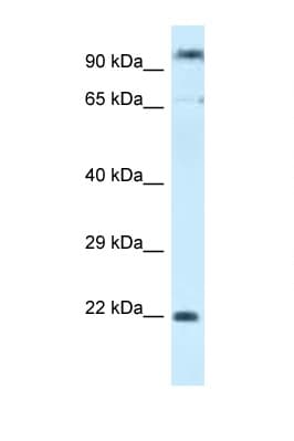 Polyclonal Rabbit anti-Human POLR3GL Antibody (C-Terminus, WB)