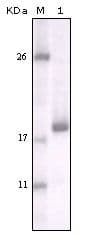 DDR2 Antibody (clone 3B11E4)