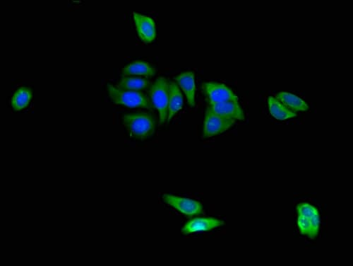 CAPZA1 / CAPZ Alpha 1 Antibody