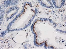 IRF6 Antibody (clone OTI2A12)