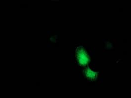 ADH2 / ADH1B Antibody (clone OTI5D7)
