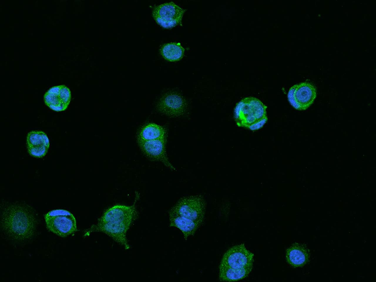 Polyclonal Rabbit anti-Human CCDC9 Antibody (IF)