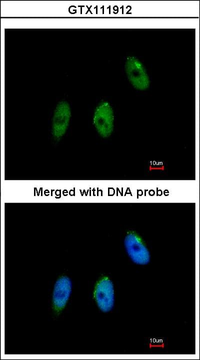 IHC-plus™ ELP3 Antibody