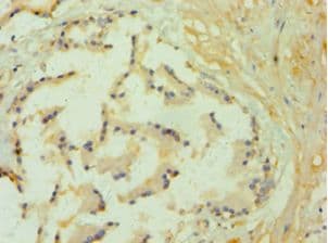 Polyclonal Rabbit anti-Human GLO1 / Glyoxalase I Antibody (aa1-184, IHC, WB)