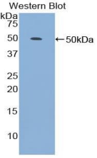 LP-PLA2 / PLA2G7 Antibody (aa22-444)