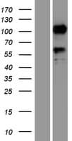 SEMA6D / Semaphorin 6D Protein (Over-Expression Lysate Myc-DDK (Flag))