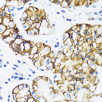 CTNNA1 / Catenin Alpha-1 Antibody