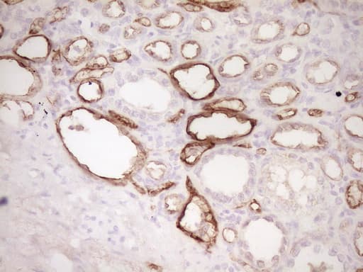 PROCR / EPCR Antibody (aa1-210, clone OTI3E7)
