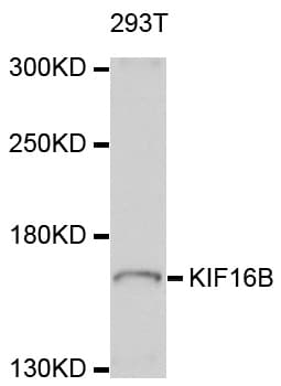 Polyclonal Rabbit anti-Human KIF16B Antibody (WB)