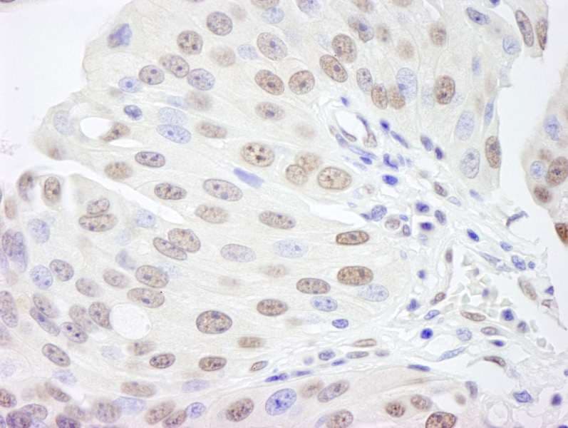 RBBP4 / RBAP48 Antibody (aa1-50)
