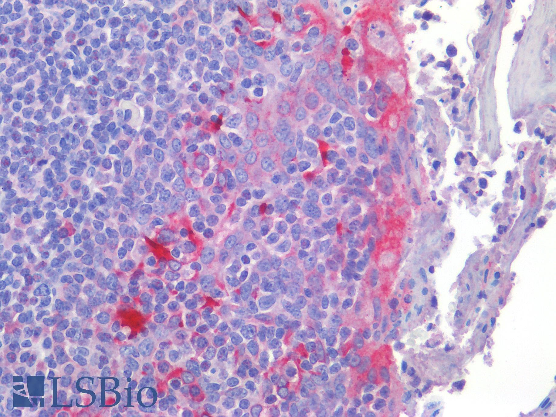 IHC-plus™ Polyclonal Rabbit anti-Human MSLN / Mesothelin Antibody (IHC)