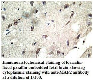 Polyclonal Rabbit anti-Human MAP2 Antibody (aa339-554, IHC)