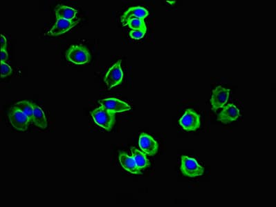 Polyclonal Rabbit anti-Human CYSLTR1 / CYSLT1 Antibody