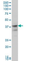 IHC-plus™ Monoclonal Mouse anti-Human MSI1 / Musashi 1 Antibody (clone 3F2, IHC, IF, WB)