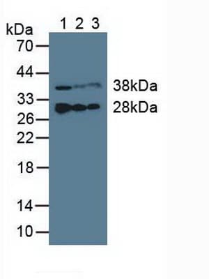 ETFB Antibody (aa2-255)