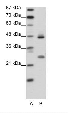 KLF6 Antibody (aa155-204)