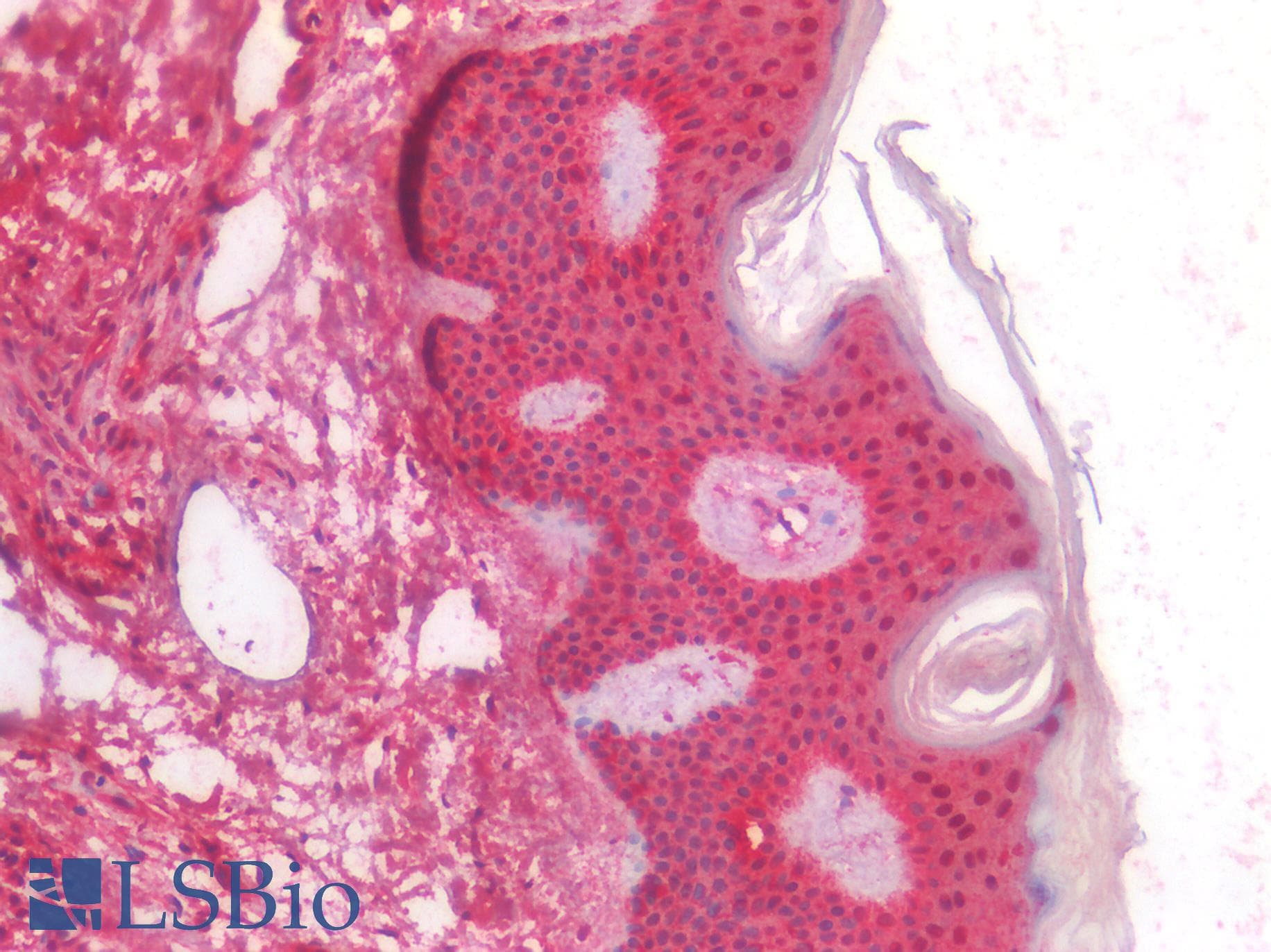 COL3A1 / Collagen III Antibody